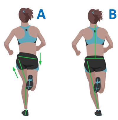 INESTABILIDAD PÉLVICA Y LESIONES EN RODILLA