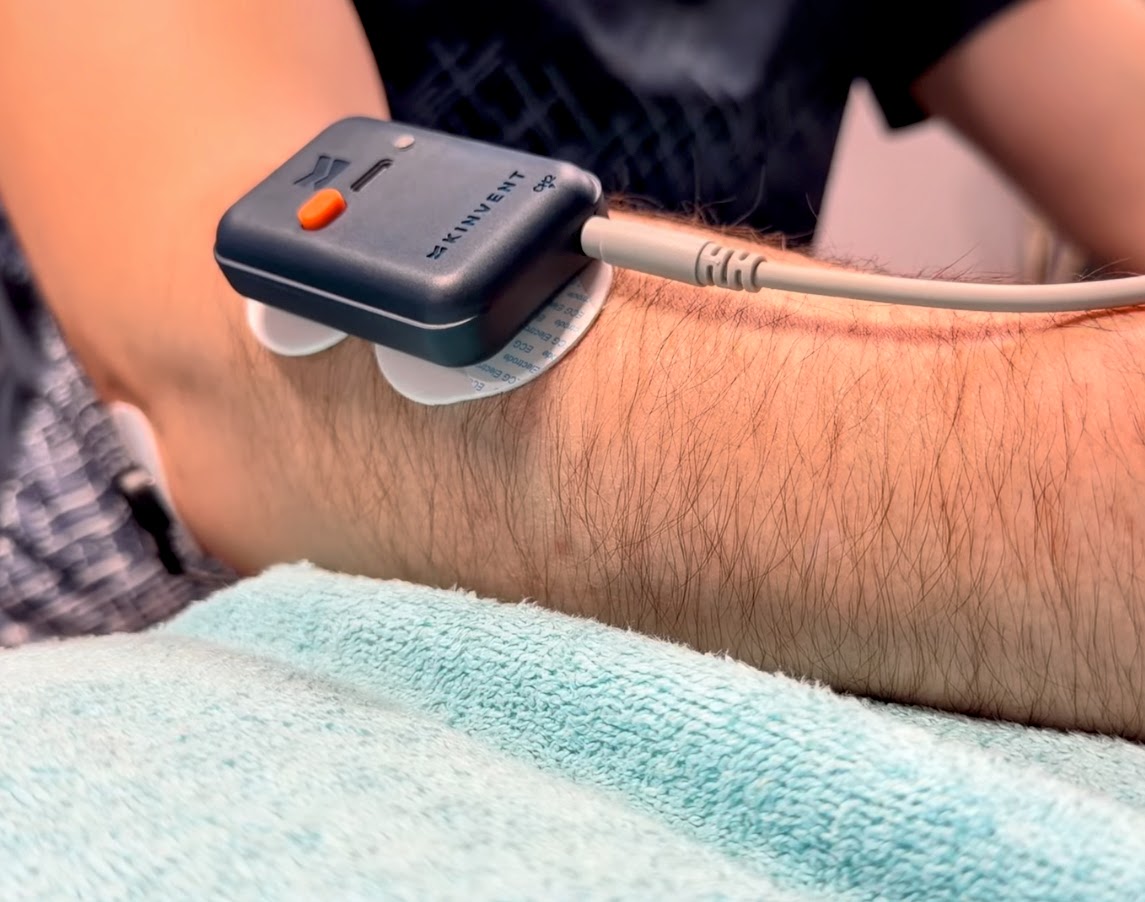 Registro de activación muscular con electromiografía de superficie