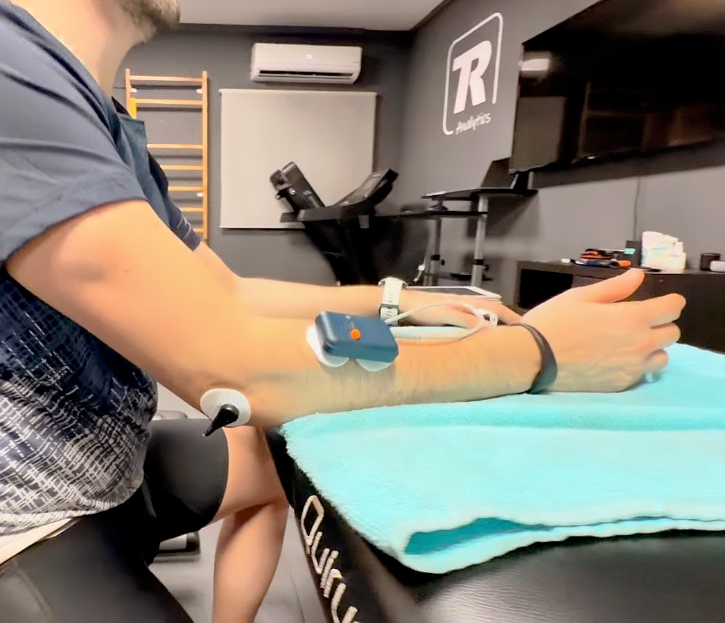 Electromiografía en antebrazo para valorar una epicondilitis lateral